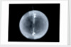 Globe x-ray by William Palmer