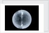 Globe x-ray by William Palmer