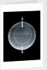 Globe x-ray by Jean Fortin