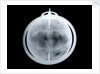 Globe x-ray by John Senex