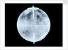 Globe x-ray by Dudley Adams