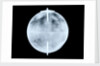 Globe x-ray by Dudley Adams