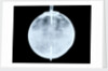 Globe x-ray by Dudley Adams