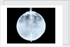 Globe x-ray by Dudley Adams