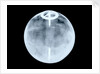 Globe x-ray by Dudley Adams