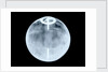 Globe x-ray by Dudley Adams