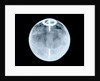 Globe x-ray by Dudley Adams