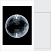 Globe x-ray by Richard Cushee