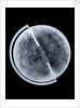 Globe x-ray by Newton Son & Berry