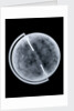 Globe x-ray by Newton Son & Berry