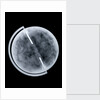 Globe x-ray by Newton Son & Berry
