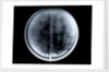 Globe x-ray by Johann Gabriel Doppelmayr