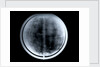 Globe x-ray by Johann Gabriel Doppelmayr