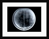 Globe x-ray by Johann Gabriel Doppelmayr