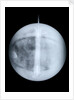 Globe x-ray by Benjamin Martin