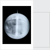 Globe x-ray by Benjamin Martin