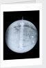 Globe x-ray by Benjamin Martin