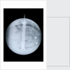 Globe x-ray by Benjamin Martin