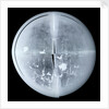 Globe x-ray by Newton Son & Berry