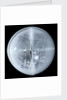 Globe x-ray by Newton Son & Berry