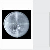 Globe x-ray by Newton Son & Berry