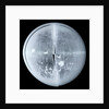 Globe x-ray by Newton Son & Berry