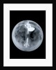 Globe x-ray by Nathaniel Hill