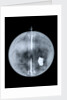 Globe x-ray by Nathaniel Hill