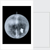 Globe x-ray by Nathaniel Hill