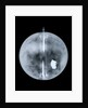 Globe x-ray by Nathaniel Hill