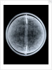 Globe x-ray by William Bardin