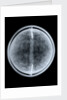 Globe x-ray by William Bardin