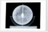 Globe x-ray by William Bardin