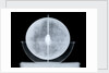 Globe x-ray by William Bardin