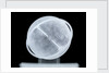 Globe x-ray by William Bardin