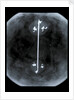 Globe x-ray by Gerard Mercator