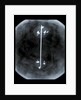 Globe x-ray by Gerard Mercator