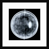 Globe x-ray by Jacob Floris van Langren