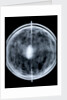 Globe x-ray by Jacob Floris van Langren