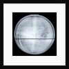 Globe x-ray by Jean Antoine Nollet