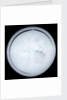 Globe x-ray by Hyacinthe Langlois