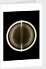 Globe x-ray by Joannes Oterschaden