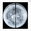 Globe x-ray by Jodocus Hondius Jr