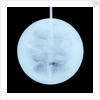 Globe x-ray by Peter Anich