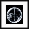 Globe x-ray by unknown