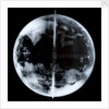 Globe x-ray by unknown