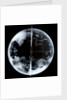 Globe x-ray by unknown