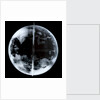 Globe x-ray by unknown