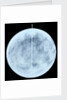 Globe x-ray by Giovanni Maria Cassini