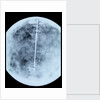 Globe x-ray by Giovanni Maria Cassini